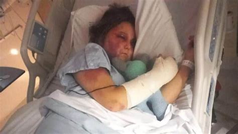 kira hart news|Teenage victim of savage Queensland beating speaks ...